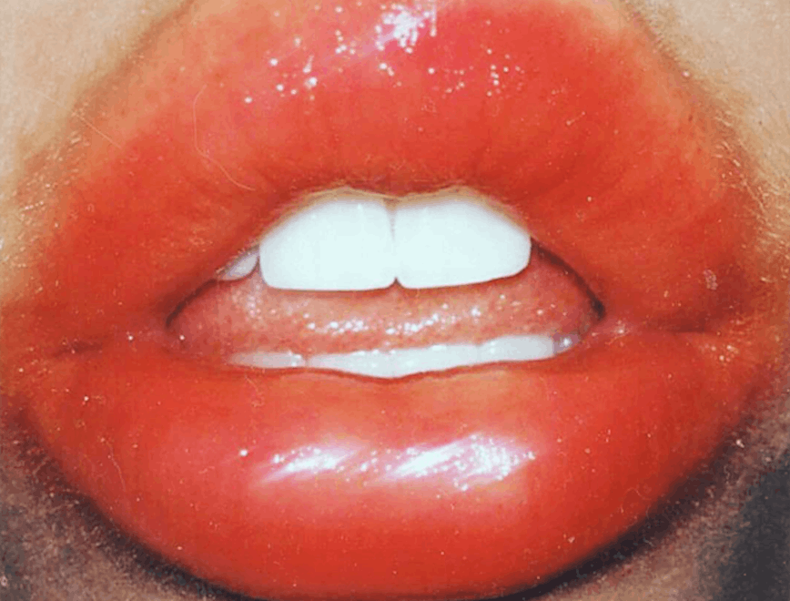 mouth lip